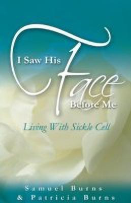 I Saw His Face Before Me - Living with Sickle Cell Anemia(English, Paperback, Burns Samuel a)