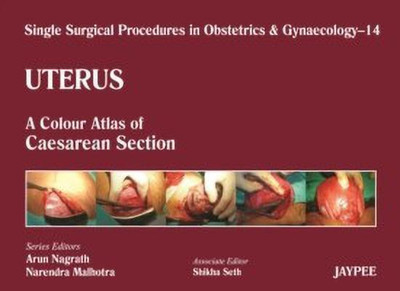 Single Surgical Procedures in Obstetrics and Gynaecology - Volume 14 - Uterus(English, Hardcover, unknown)