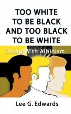 Too White to be Black and Too Black to be White(English, Hardcover, Edwards Lee G.)