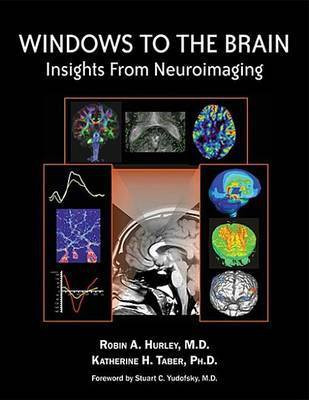 Windows to the Brain(English, Electronic book text, Hurley Robin A)