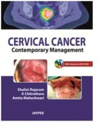 Cervical Cancer(English, Paperback, Rajaram Shalini)