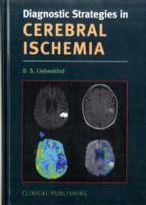 Cerebral Ischemia(English, Hardcover, unknown)