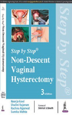 Step by Step: Non-Descent Vaginal Hysterectomy(English, Paperback, Goel Neerja)