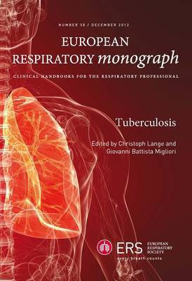 Tuberculosis(English, Paperback, unknown)