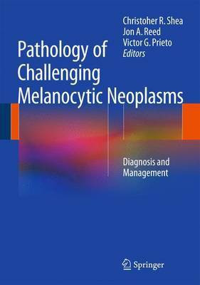 Pathology of Challenging Melanocytic Neoplasms; Diagnosis and Management(English, Electronic book text, unknown)