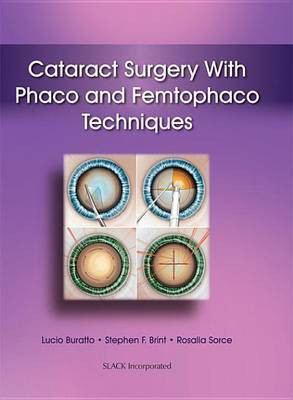 Cataract Surgery with Phaco and Femtophaco Techniques(English, Electronic book text, unknown)