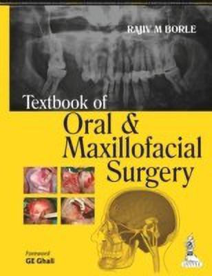 Textbook of Oral and Maxillofacial Surgery(English, Paperback, Borle Rajiv M)