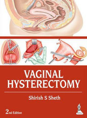 Vaginal Hysterectomy(English, Hardcover, Sheth Shirish S)