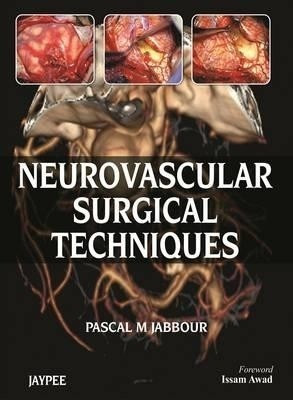 Neurovascular Surgical Techniques(English, Hardcover, Jabbour Pascal M)