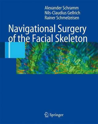 Navigational Surgery of the Facial Skeleton(English, Electronic book text, Schramm Alexander)