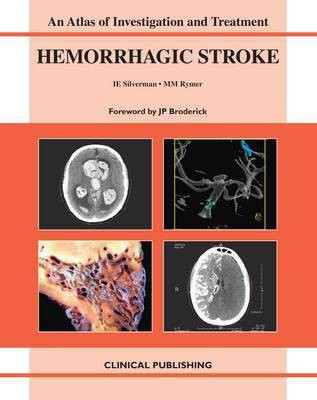 Hemorrhagic Stroke(English, Electronic book text, unknown)