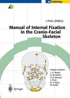 Manual of Internal Fixation in the Cranio-Facial Skeleton(English, Paperback, unknown)