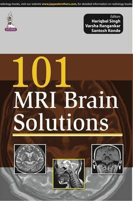 101 MRI Brain Solutions(English, Paperback, Singh Hariqbal)
