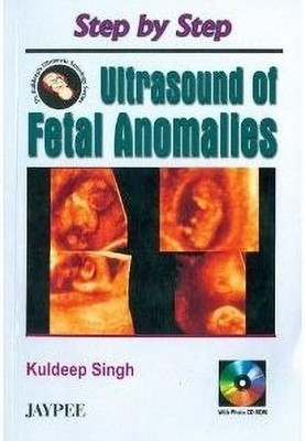 Step by Step Ultrasound of Fetal Anomalies(English, Paperback, Singh Kuldeep)