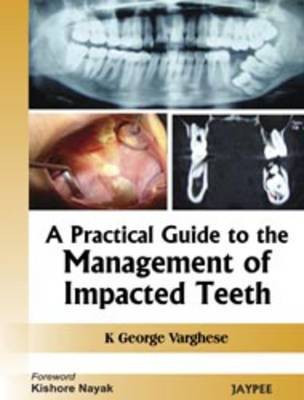 A Practical Guide to the Management of Impacted Teeth(English, Paperback, Varghese George K)