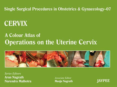 Single Surgical Procedures in Obstetrics and Gynaecology - Volume 7 - CERVIX - A Colour Atlas of Operations on the Uterine Cervix(English, Hardcover, Nagrath Arun)