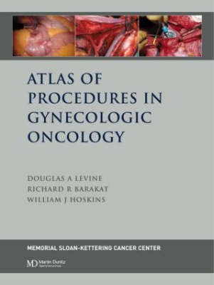 Atlas of Procedures in Gynecologic Oncology, 1st Ed(English, Hardcover, Levine Douglas)