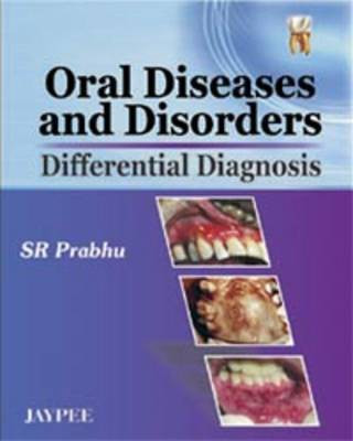Oral Diseases and Disorders(English, Paperback, Prabhu S R)