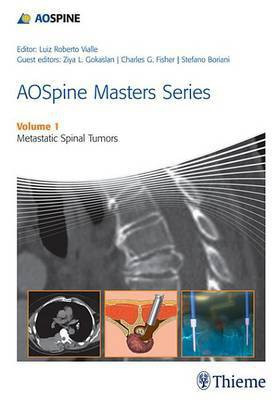 Aospine Masters Series(English, Electronic book text, unknown)