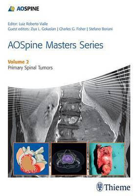 Aospine Masters Series(English, Electronic book text, unknown)