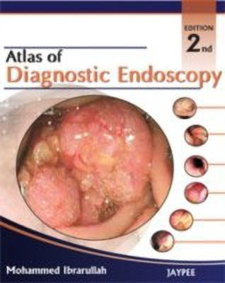 Atlas of Diagnostic Endoscopy(English, Hardcover, Ibrarullah Mohammad)