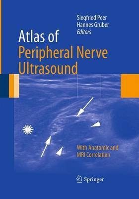 Atlas of Peripheral Nerve Ultrasound(English, Paperback, unknown)