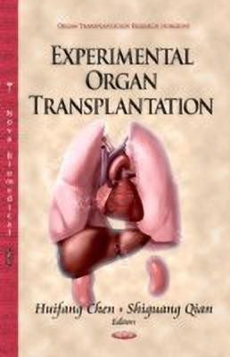 Experimental Organ Transplantation(English, Hardcover, unknown)