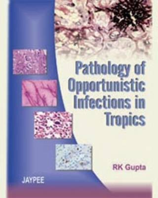 Pathology of Opportunistic Infections in Tropics(English, Hardcover, Gupta RK)