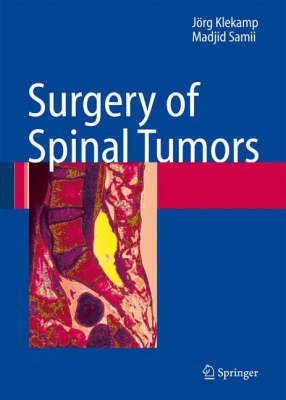 Surgery of Spinal Tumors(English, Hardcover, Klekamp Joerg)