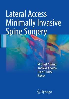 Lateral Access Minimally Invasive Spine Surgery(English, Paperback, unknown)