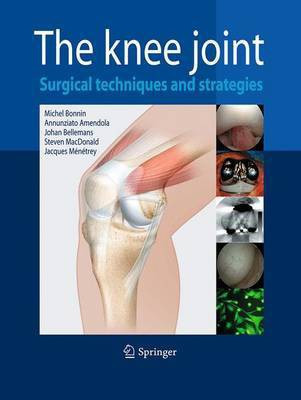 The Knee Joint(English, Paperback, unknown)