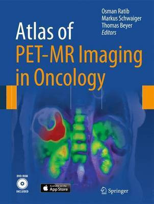 Atlas of PET/MR Imaging in Oncology(English, Mixed media product, unknown)