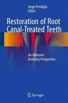 Restoration of Root Canal-Treated Teeth(English, Hardcover, unknown)