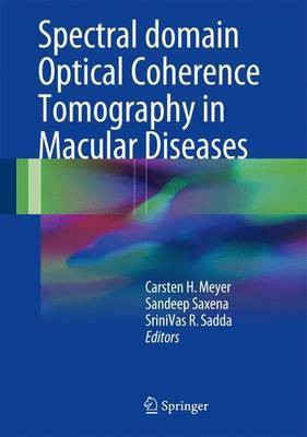 Spectral Domain Optical Coherence Tomography in Macular Diseases(English, Hardcover, unknown)