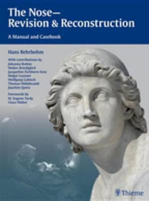 Nose - Revision and Reconstruction(English, Electronic book text, Behrbohm Hans)