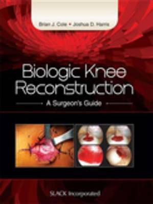 Biologic Knee Reconstruction(English, Electronic book text, unknown)