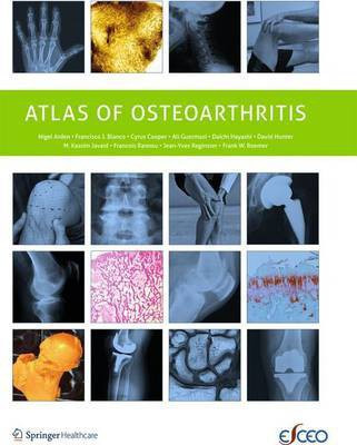 Atlas of Osteoarthritis(English, Electronic book text, unknown)