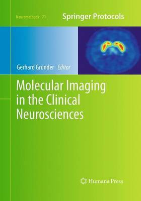 Molecular Imaging in the Clinical Neurosciences(English, Paperback, unknown)