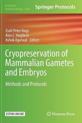 Cryopreservation of Mammalian Gametes and Embryos(English, Hardcover, unknown)