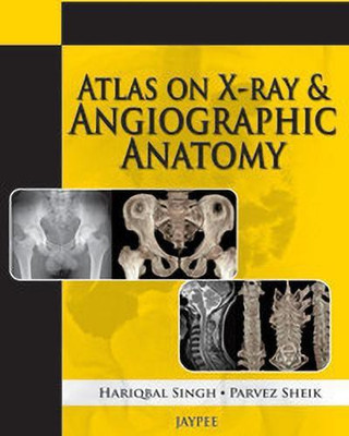 Atlas on X-Ray and Angiographic Anatomy(English, Paperback, Singh Hariqbal)