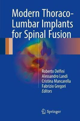 Modern Thoraco-Lumbar Implants for Spinal Fusion(English, Hardcover, unknown)