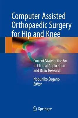 Computer Assisted Orthopaedic Surgery for Hip and Knee(English, Hardcover, unknown)