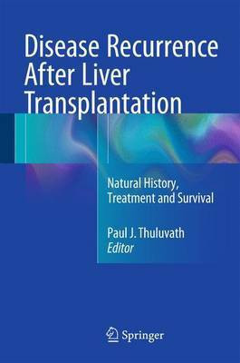 Disease Recurrence After Liver Transplantation(English, Hardcover, unknown)