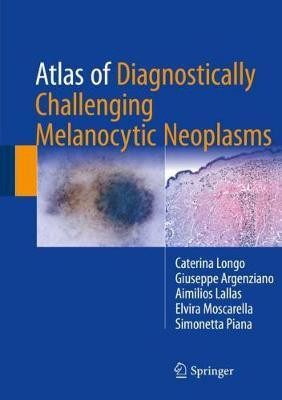 Atlas of Diagnostically Challenging Melanocytic Neoplasms(English, Hardcover, Longo Caterina)