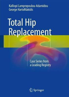 Total Hip Replacement(English, Hardcover, Lampropoulou-Adamidou Kalliopi)
