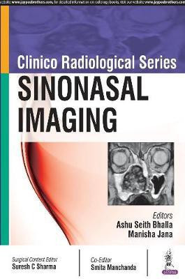 Clinico Radiological Series: Sinonasal Imaging(English, Paperback, Bhalla Ashu Seith)