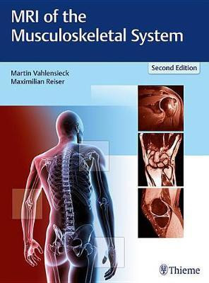 MRI of the Musculoskeletal System(English, Hardcover, unknown)