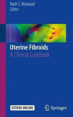 Uterine Fibroids(English, Paperback, unknown)
