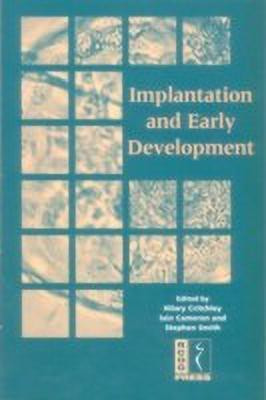 Implantation and Early Development(English, Paperback, unknown)