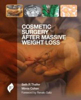 Cosmetic Surgery after Massive Weight Loss(English, Hardcover, Thaller Seth)